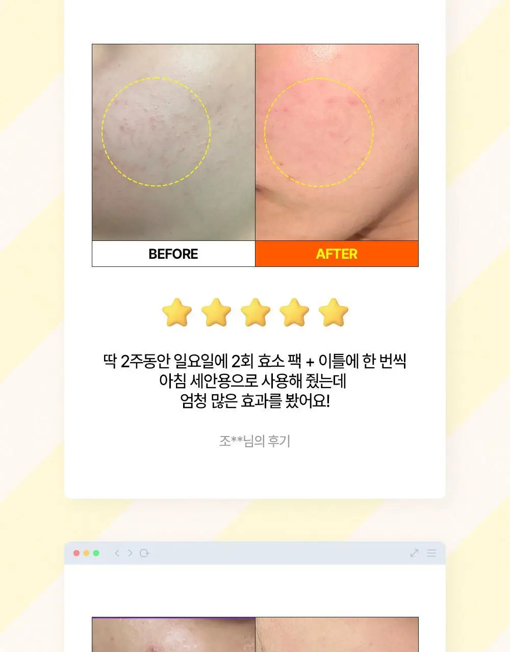 [온라인 단독] 파파레서피 블레미쉬 효소 파우더 클렌저 50g 더블기획 (+브러쉬+블레미쉬 크림 7ml) 상세페이지 7